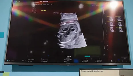 Why We Show Up for Care